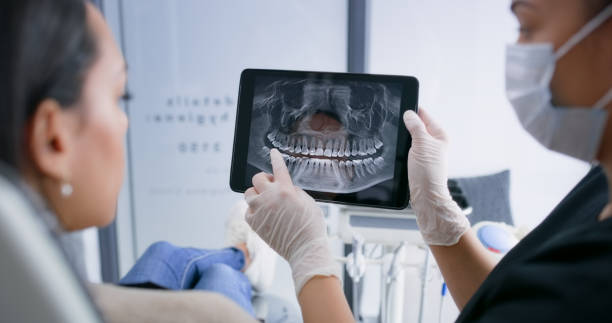 Licensed Tooth Extraction service in Spanish Fork, UT - Smile Center Dentistry
